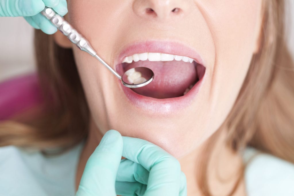 Dental Fillings in Towson, Maryland
