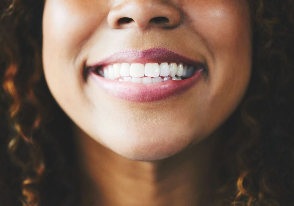 Close-up image of woman smiling with gorgeous smile white teeth cosmetic dentistry dentist in Towson Maryland