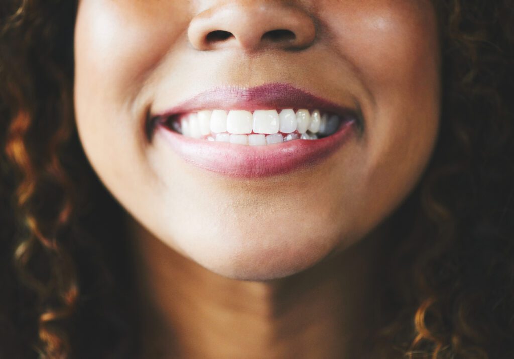 Cosmetic dentistry is an integral facet of dental care that focuses on improving the appearance of your teeth and smile.